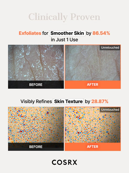 COSRX 5 PDRN Hyaluronic Acid Vital Hydrating Hydrogel Mask