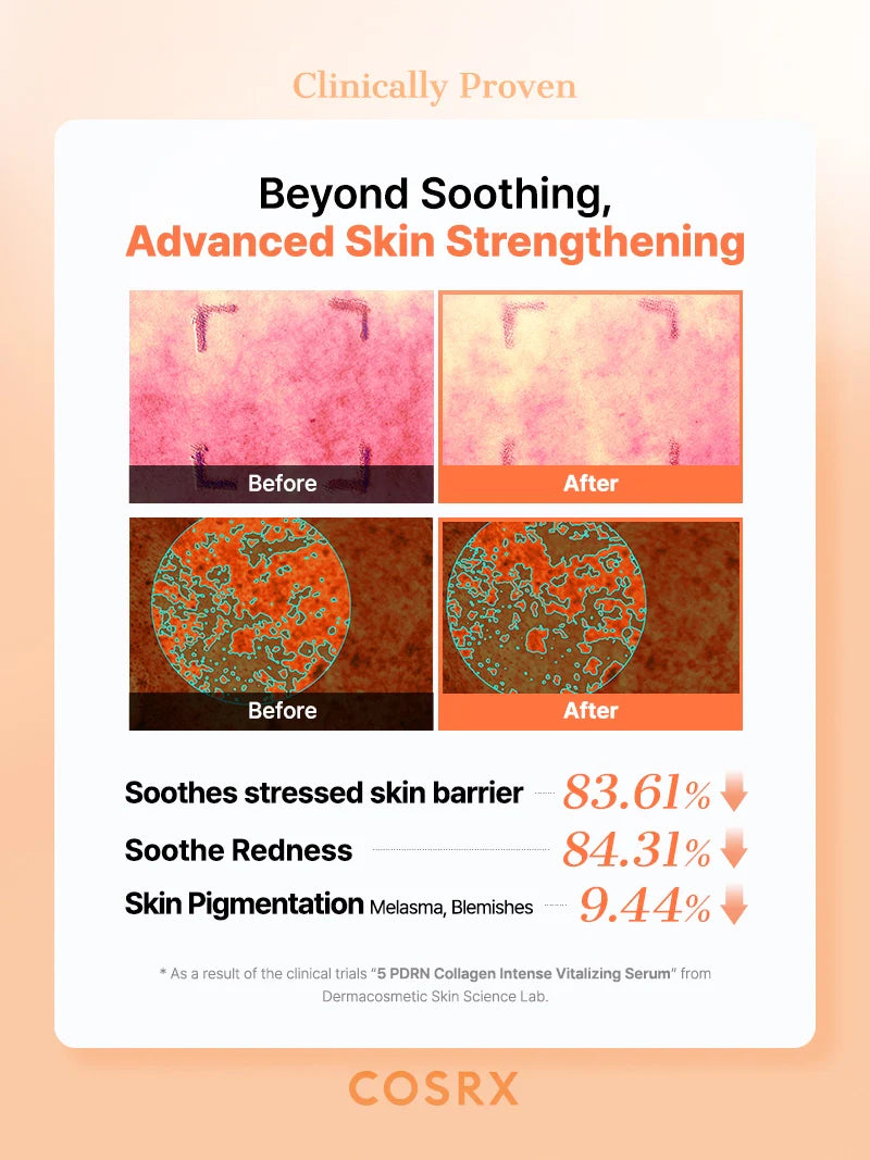 COSRX 5 PDRN Collagen Intense Vitalizing Serum